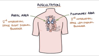 Heart Murmurs and Heart Sounds: Visual Explanation for Students