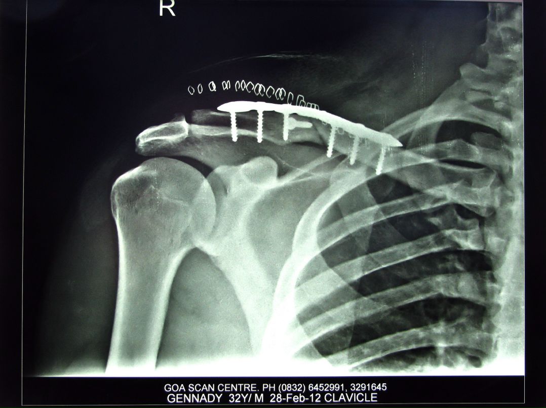 Геннадий Минцев | Москва