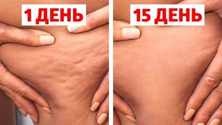 ЦЕЛЛЮЛИТ УЙДЕТ НАВСЕГДА, ЕСЛИ ДЕЛАТЬ ЭТО КАЖДЫЙ ДЕНЬ!