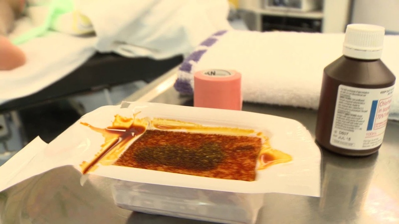 Surgical Site Infection Improvement Programme surgical skin